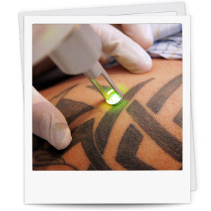 Detattoo Pro Tattoo removal Machine