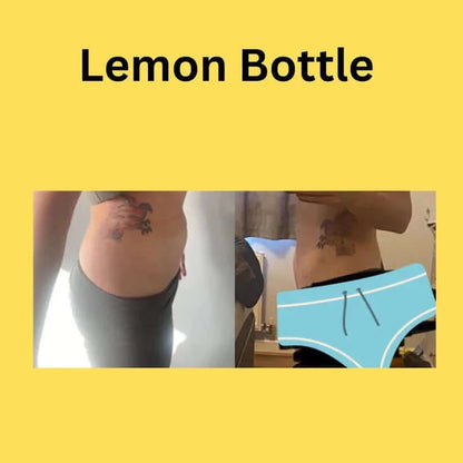 Before and after results of using Lemon Bottle 5x10ml Vials, promoting beauty aesthetics and fat metabolism activation.